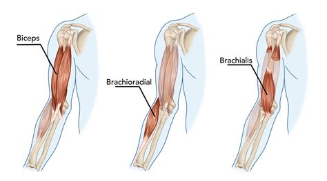 What Causes a Bicep to Tear: How to Prevent and Treatment Options - Power of Prevention (POP)