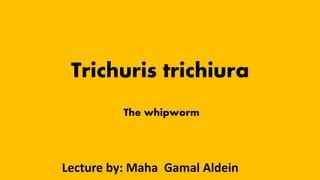 Trichuris trichiura | PPT