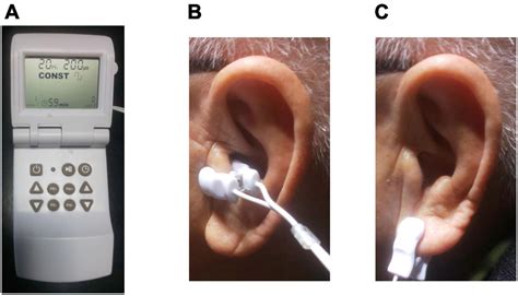 Frontiers Afterload Reduction After Non-invasive Vagus, 51% OFF