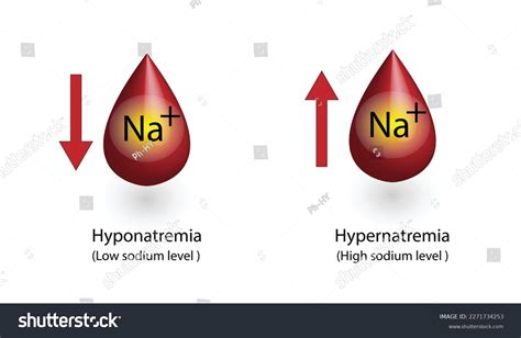 Sodium Ion Symbol