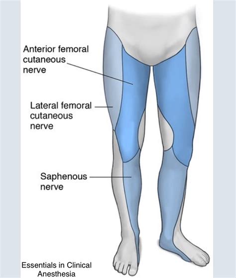 PNBschool - Lateral Femoral Cutaneous Nerve Block...