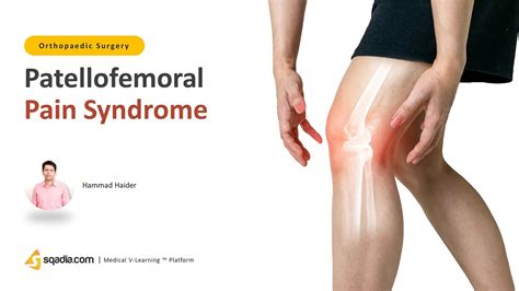 Patellofemoral Pain Syndrome