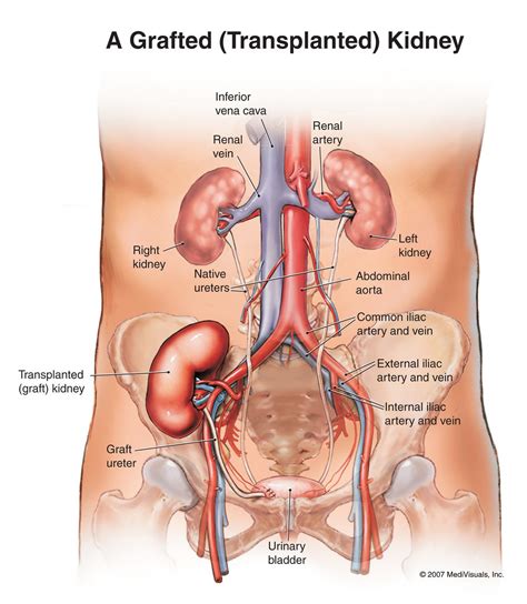 Free For Health: Kidney Pain Causes