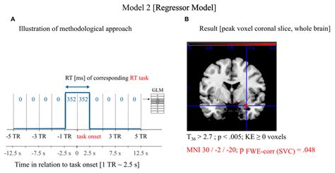 Neuroimaging data analysis and results. (A) Graphical illustration of... | Download Scientific ...