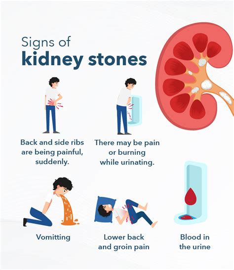 Left Kidney Pain Symptoms Causes And Treatments