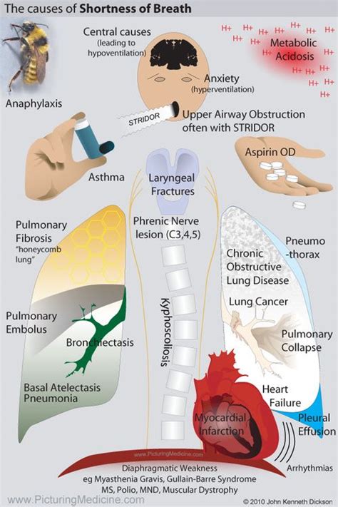 Causes of Shortness of Breath Nursing Labs, Icu Nursing, Nursing Study, Nursing Notes, Surgical ...