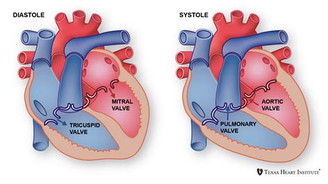 Diseases of the Mitral Valve | Texas Heart Institute