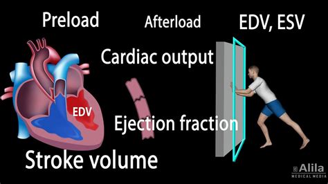 Cardiac Output, Stroke volume, EDV, ESV, Ejection Fraction - YouTube