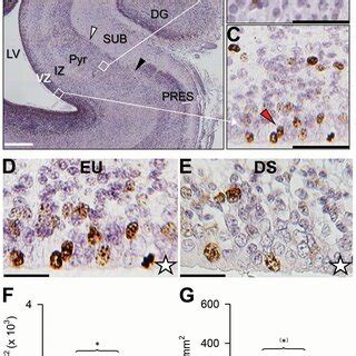 Anatomy of the subiculum in neonate mice. A–D. Nissl‐stained coronal... | Download Scientific ...