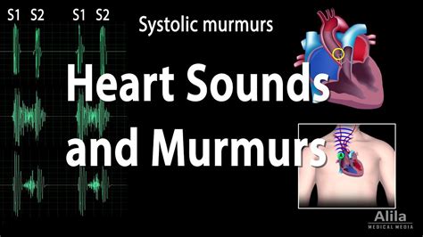 Heart Murmur Sounds | Faculty of Medicine