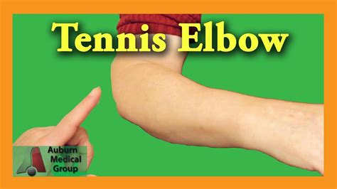 [DIAGRAM] Diagram Of Elbow Wart - MYDIAGRAM.ONLINE