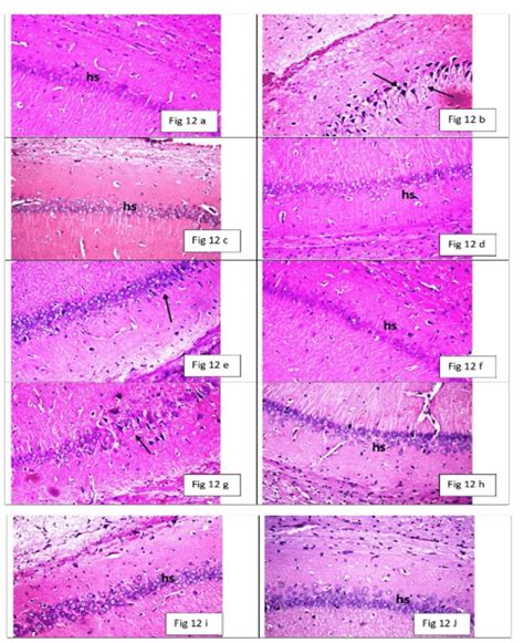 Representative Photomicrographs Of Subiculum Of Hippocampus From Brain... | Download Scientific ...