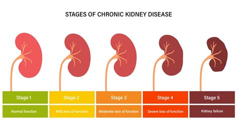 Kidney Disease