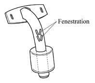 Fenestrated Tracheostomy Tube • LITFL • CCC Airway