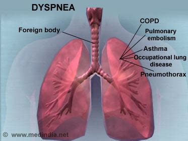 Dyspnea / Shortness of Breath