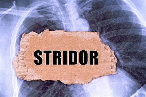 Stridor (Noisy Breathing) In Children: Causes And Treatment - UsParenting.com