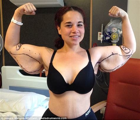 Woman who lost 120lbs raising money for loose skin surgery | Daily Mail Online