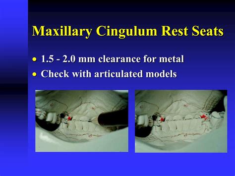 PPT - Rests & Rest Seats PowerPoint Presentation - ID:301299