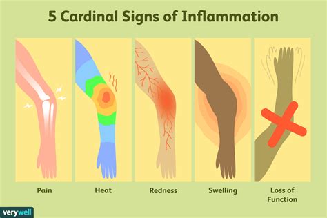 Signs of Inflammation and How to Flush it Out