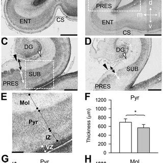 Anatomy of the subiculum in neonate mice. A–D. Nissl‐stained coronal... | Download Scientific ...