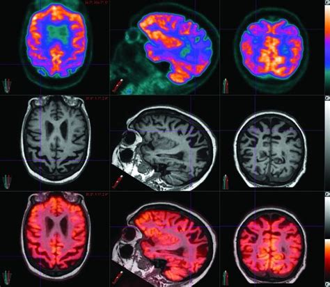 Common Techniques Used in Neuroimaging | Radiology Key