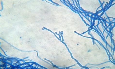 Dermatophytes in KOH mount. | Download Scientific Diagram