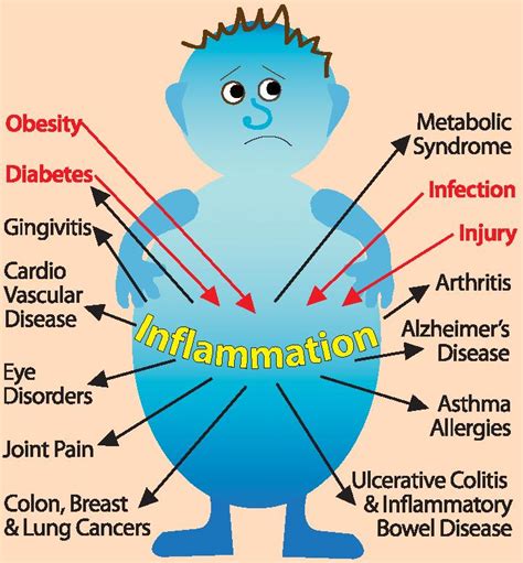 INFLAMMATION - Myremedy