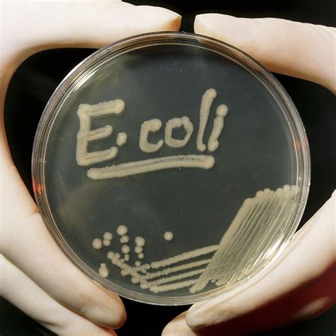 Petri Dish Culture Of E.coli Bacteria by Dr Jeremy Burgess | Petri dish, Jeremy, Dishes