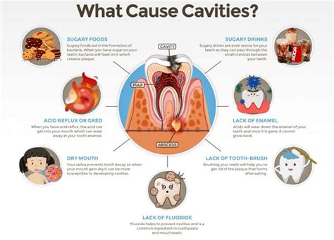 How does a tooth decay? – Sabka Dentist – Top Dental Clinic Chain In India | Best Dentists Near Me