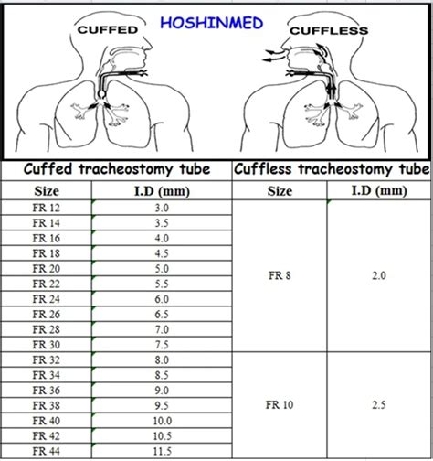 Customed Different Sizes Anti-infective Tracheostomy Tube With Disposable Inner Cannula - Buy ...