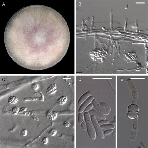 Fusarium Oxysporum