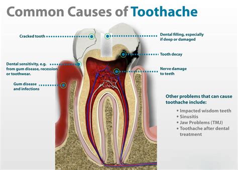 Tooth Sensitivity: Here Are The Myths And Tips