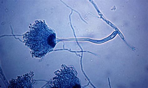 Aspergillus Microscope