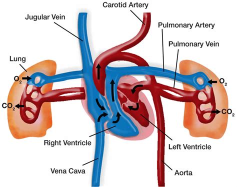 Pulmonary hypertension & pulmonary arterial hypertension causes, symptoms & treatment