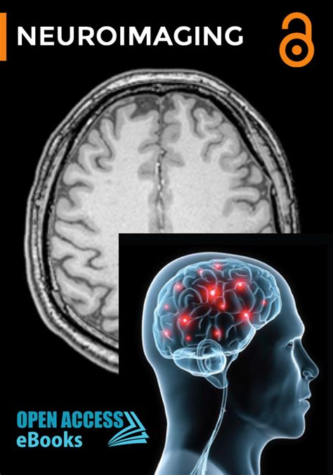 Neuroimaging