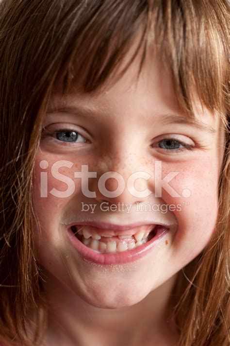 Portrait Little Girl With Two Missing Front Teeth Stock Photo | Royalty-Free | FreeImages