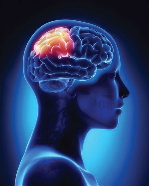 Stroke Connection - Summer 2018 When Stroke Affects the Parietal Lobe Brain Anatomy, Human Body ...