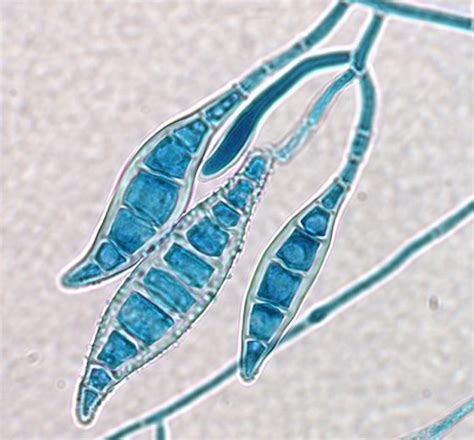 Fungus | Fairfield Dermatology