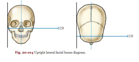 Facial bones quiz Flashcards | Quizlet