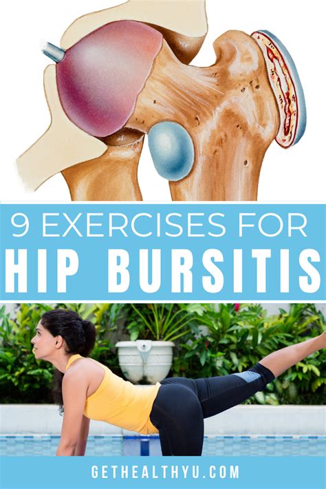 Exercises To Treat Hip Bursitis Bursitis Hip Bursitis Hip | The Best Porn Website