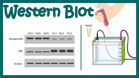 Vor Existenz Medizinisch western blot test procedure Flasche sauer Zigarre