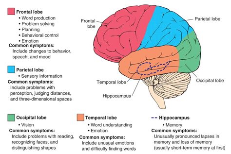 Dementia.sg