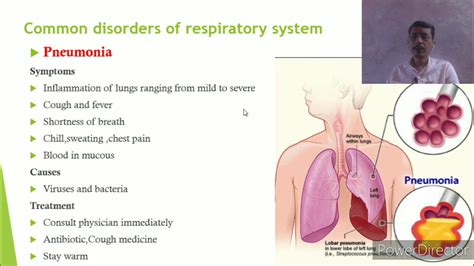 Common Disorders Of Respiratory System Youtube - Bank2home.com