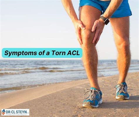 Symptoms of a Torn ACL Dr. CL Steyn Inc - Shoulder Surgeon - Cape Town https://shoulderdoc.co.za ...