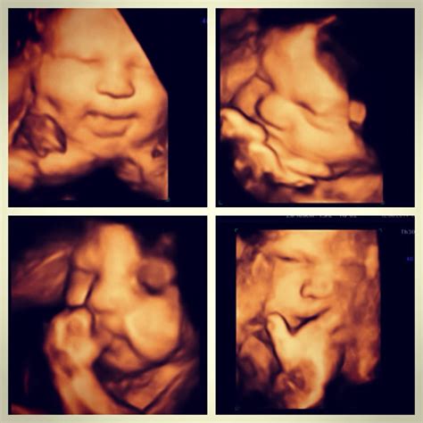 30 weeks pregnant 4d ultrasound - nibhtwc