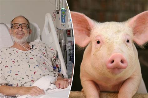 MxM News - Second-ever pig heart transplant saves dying man: ‘Now I have hope’