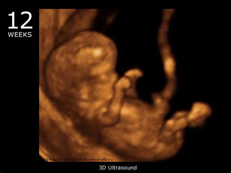 9 Weeks Pregnant 3d Ultrasound