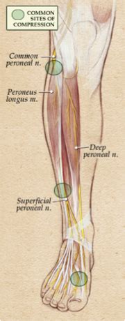 Peripheral Nerve Surgery | Neurosurgery Tasmania