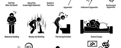 Symptoms and Causes of Appendicitis - GBL Hospital