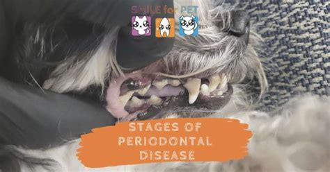 Stages of Periodontal Disease - Oral Health